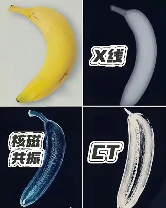 核CT、核磁共振、X光区别[思考]