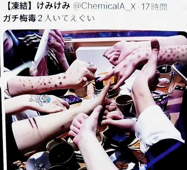 日本梅毒感染人数持续处于高位，年轻人聚众晒梅毒，为何会这样？
日本梅毒单从数据上