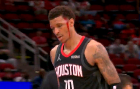 史密斯头部意外受伤血流不止，随后独自走回更衣室