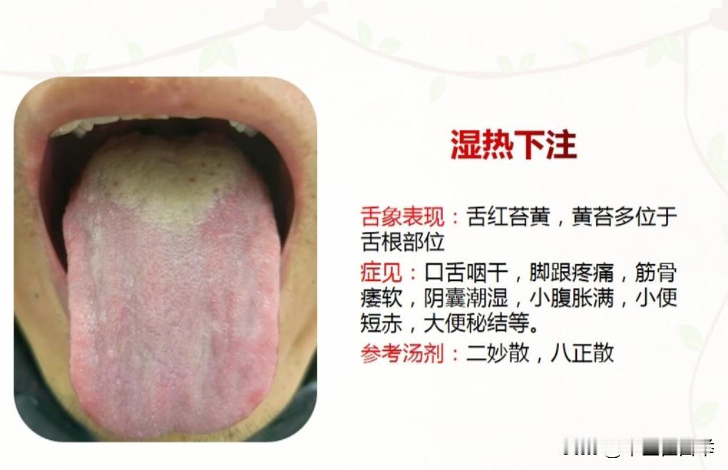 别一说清热利湿，就知道用龙胆泻肝丸了，湿热的不同类型，帮你对症用药
#中医##养