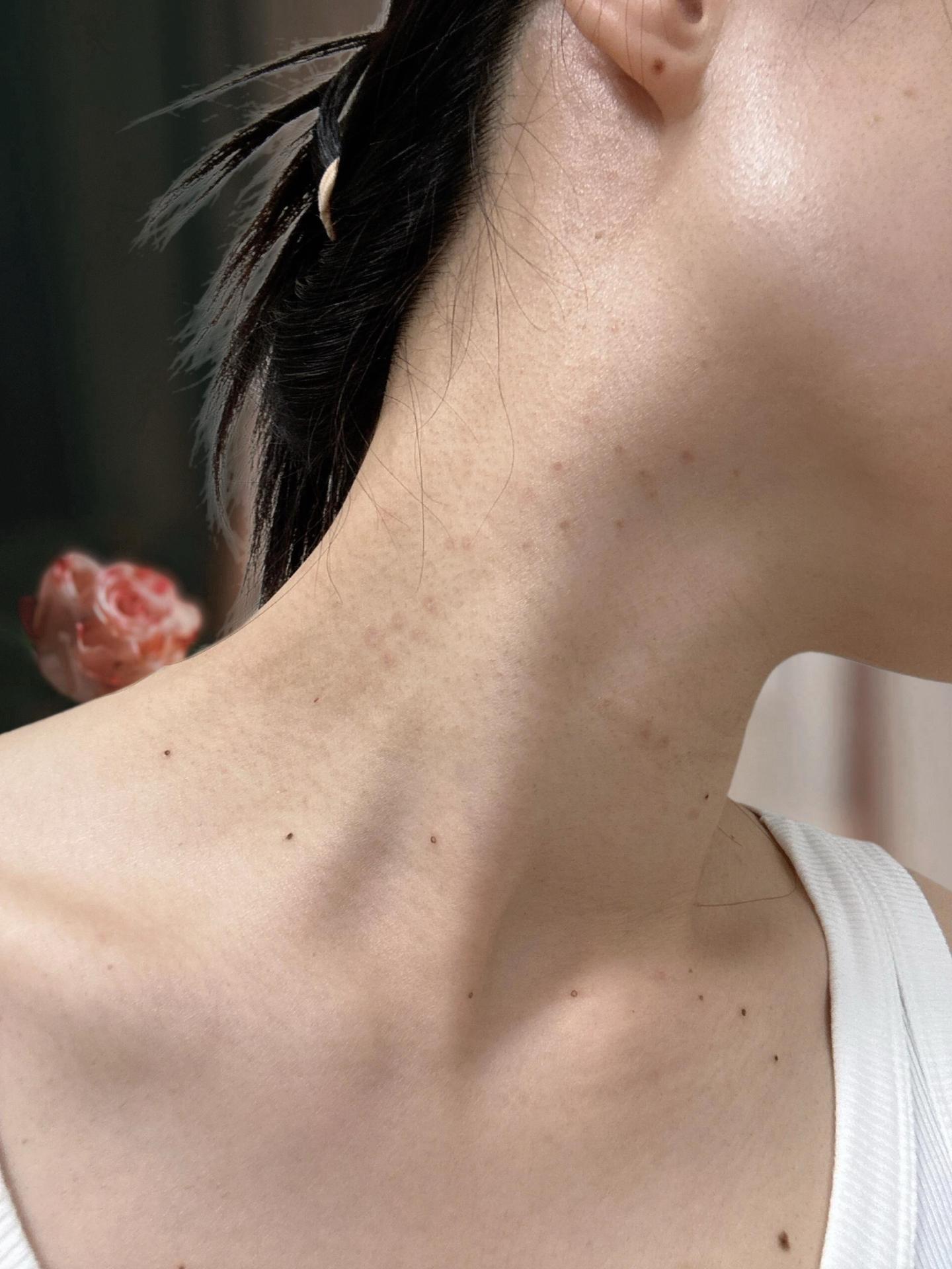 闺蜜推荐的，直的好好用心用了一个礼拜就好了，再也不尴尬了