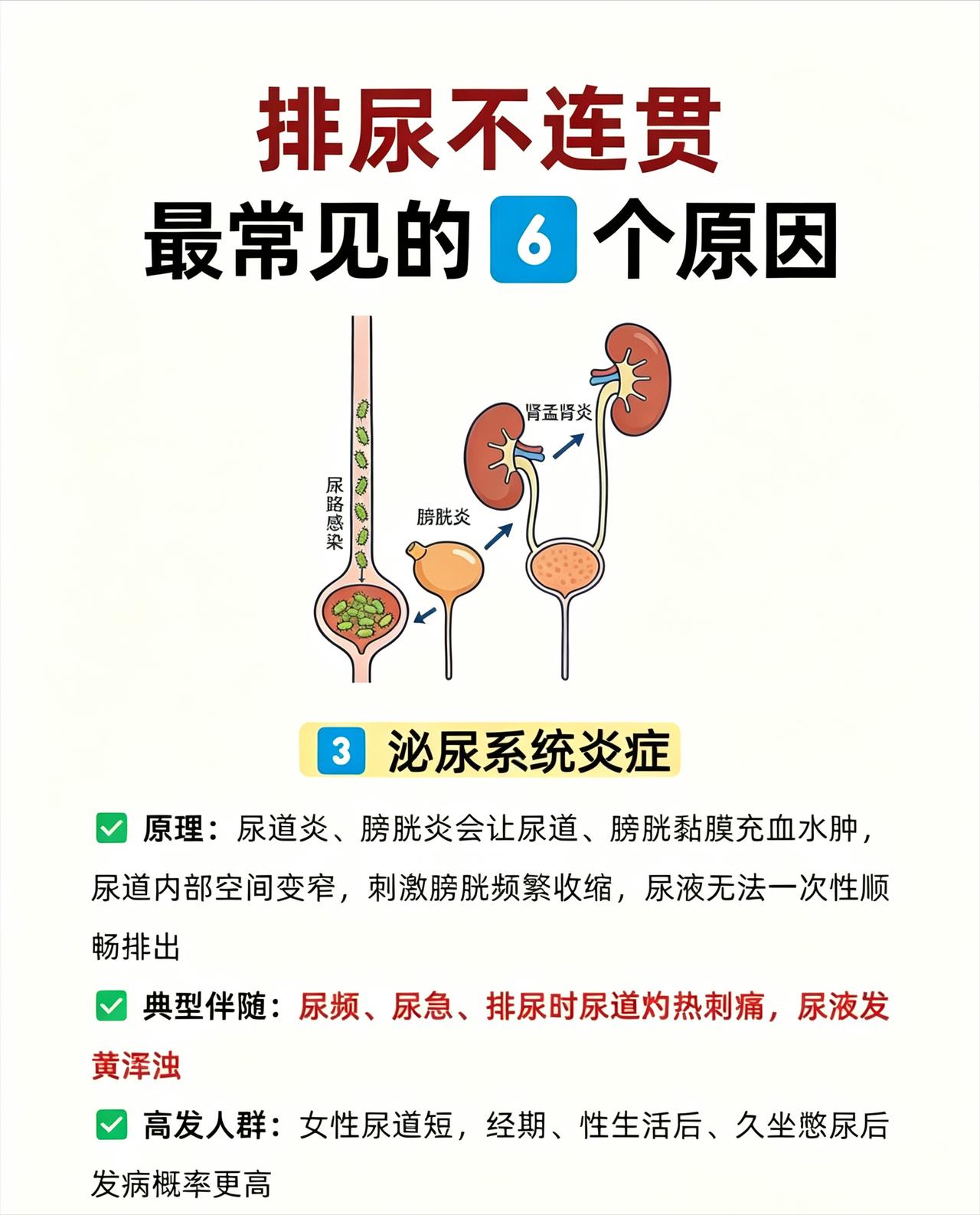 排尿不连贯是什么原因？6 种情况一次性讲清