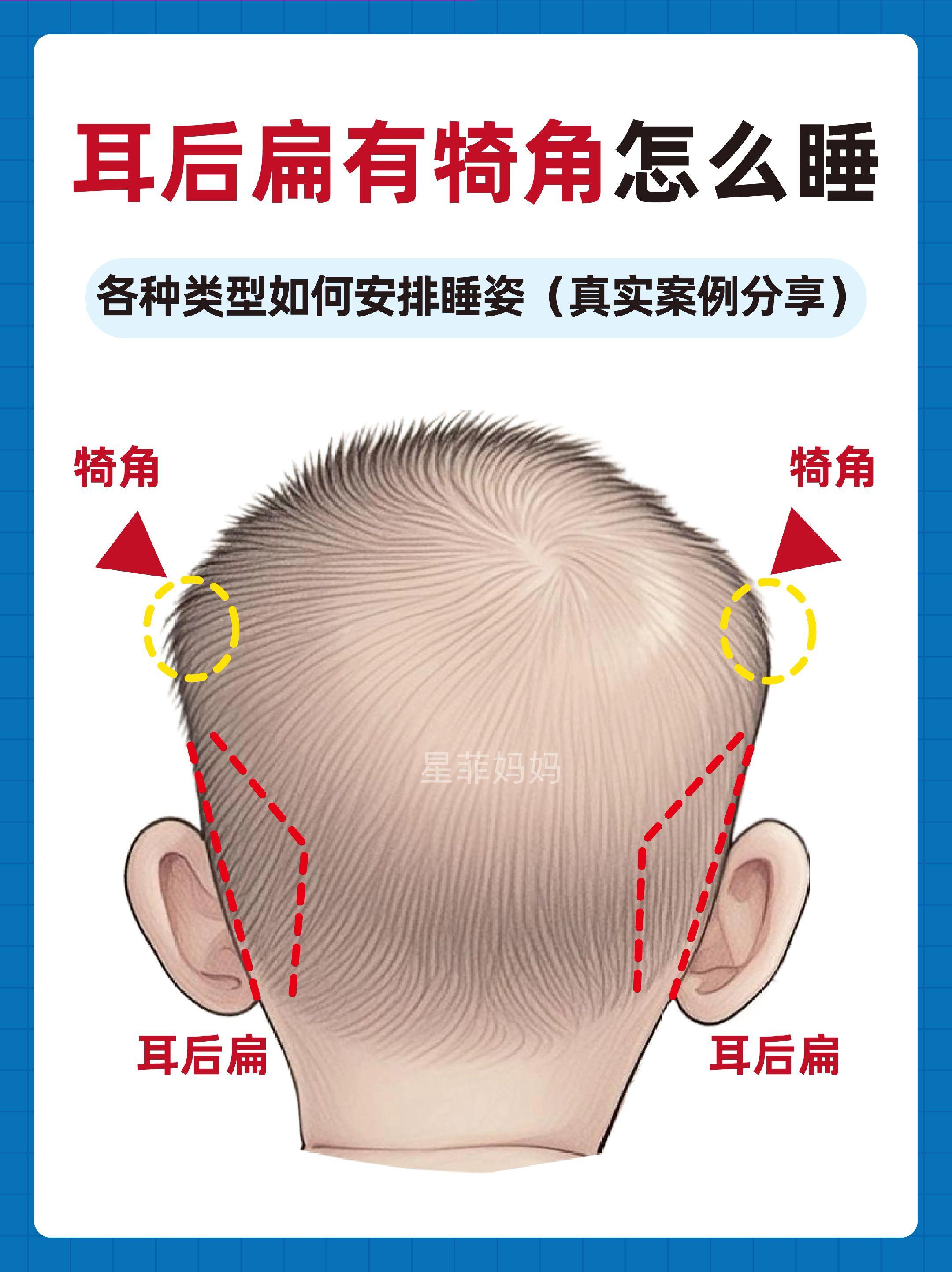 耳后扁有犄角的调整方法。