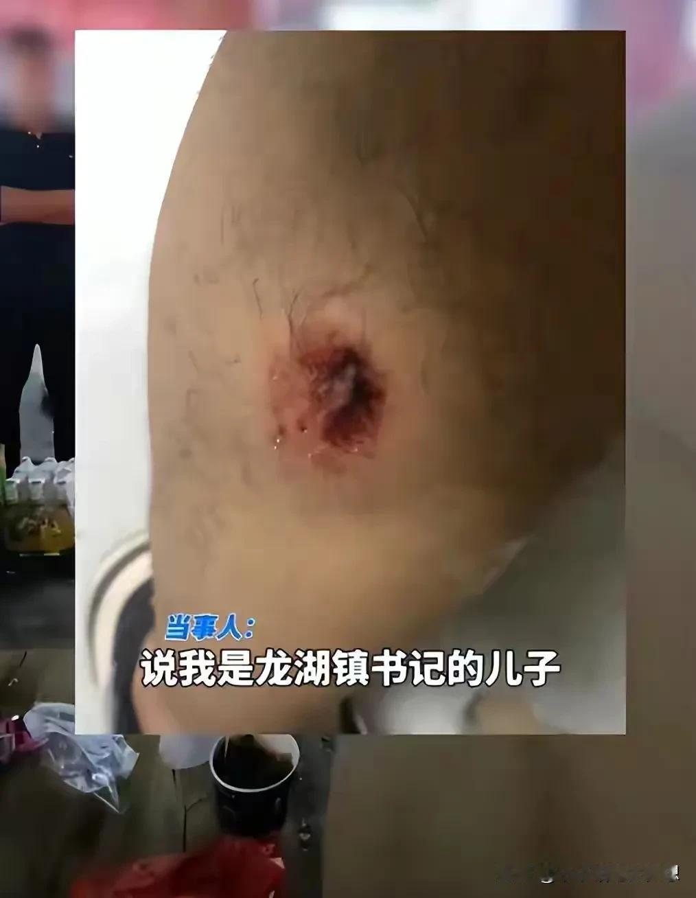 河南两名男子酒后骚扰十岁女孩并殴打其父亲，打人者是龙湖镇书记的儿子？官方出来辟谣