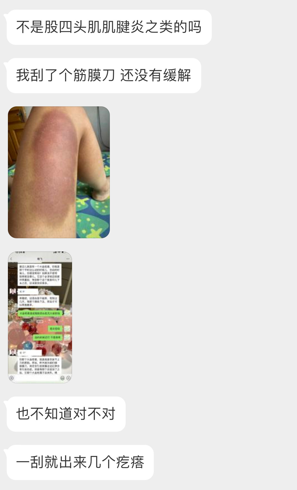 筋膜刀的真相 最近发了筋膜刀的科普视频，就想起前段时间后台收到的私信[跪了][跪