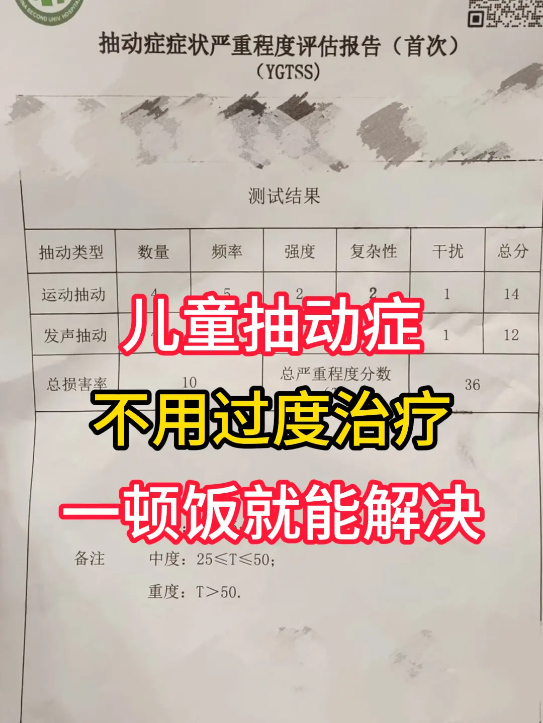 儿童抽动症不用过度治疗，一顿饭就能解决。
