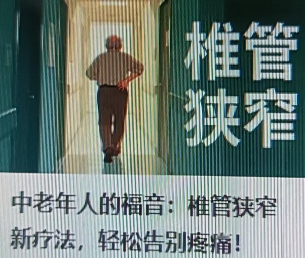 家里有中老年人的一定要多留意！椎管狭窄这毛病可太折磨人了，很多中老年人都深受其害