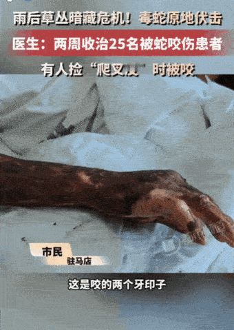 悲剧还是发生了！河南，一男子雨后去草丛捡拾“爬叉皮”时，被突然窜出的毒蛇死死咬住