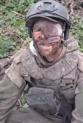 图文：受伤俄军士兵在乌克兰战场上等待撤离的时间从48小时至90天不等

受伤的俄