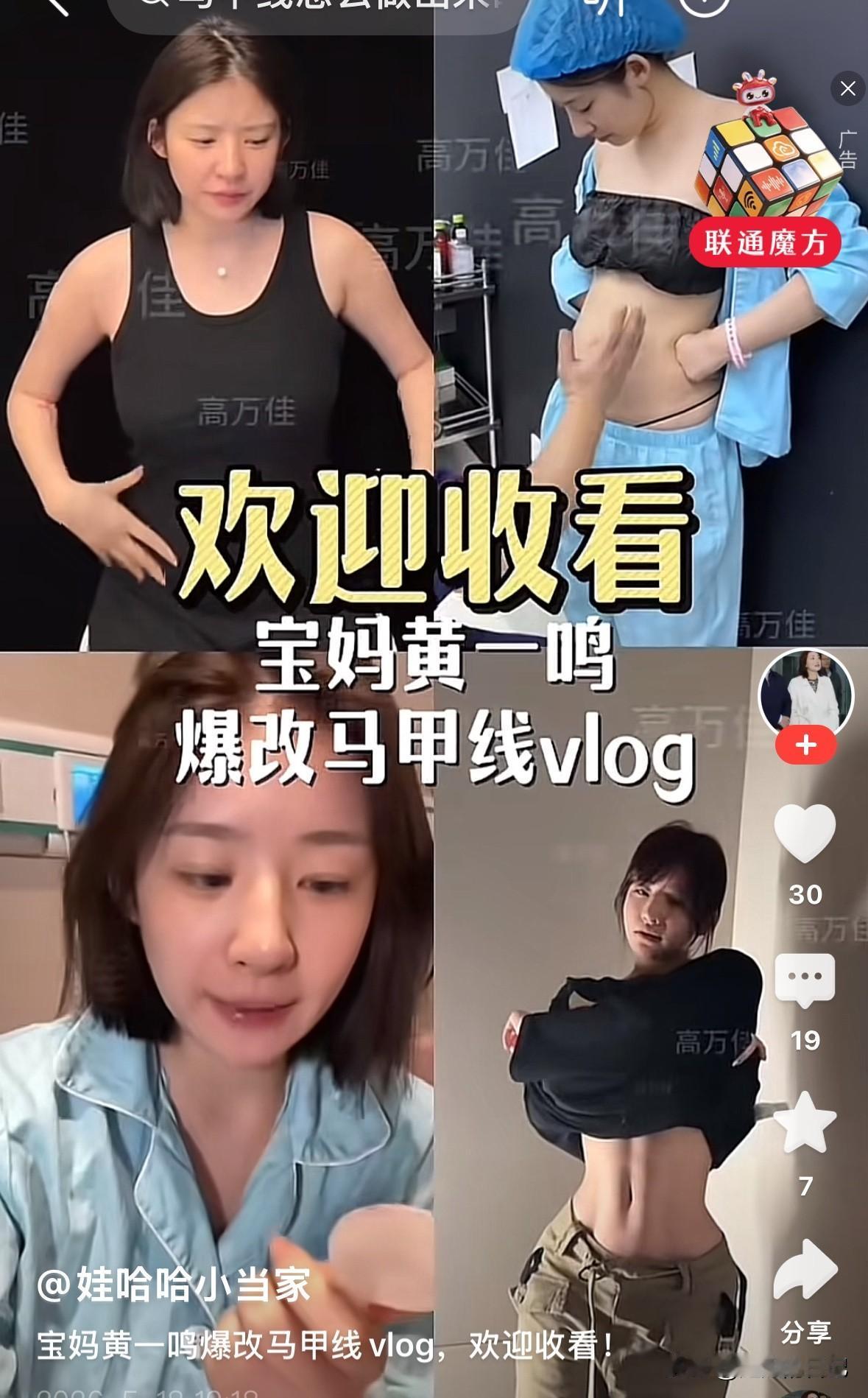 黄一鸣没做马甲线和做完后的对比图，看着有点吓人，感觉她的方式有问题。

黄一鸣生