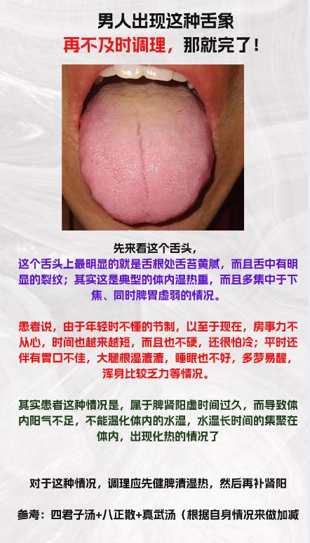 男性朋友出现这样的舌象，再不及时调理，身体就完了

#中医##肾虚##养生#
