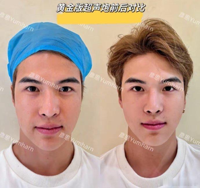 宋浩然整成李佳琦了家人们，今天要和大家聊一个超炸裂的事儿 —— 宋浩然整成李佳琦