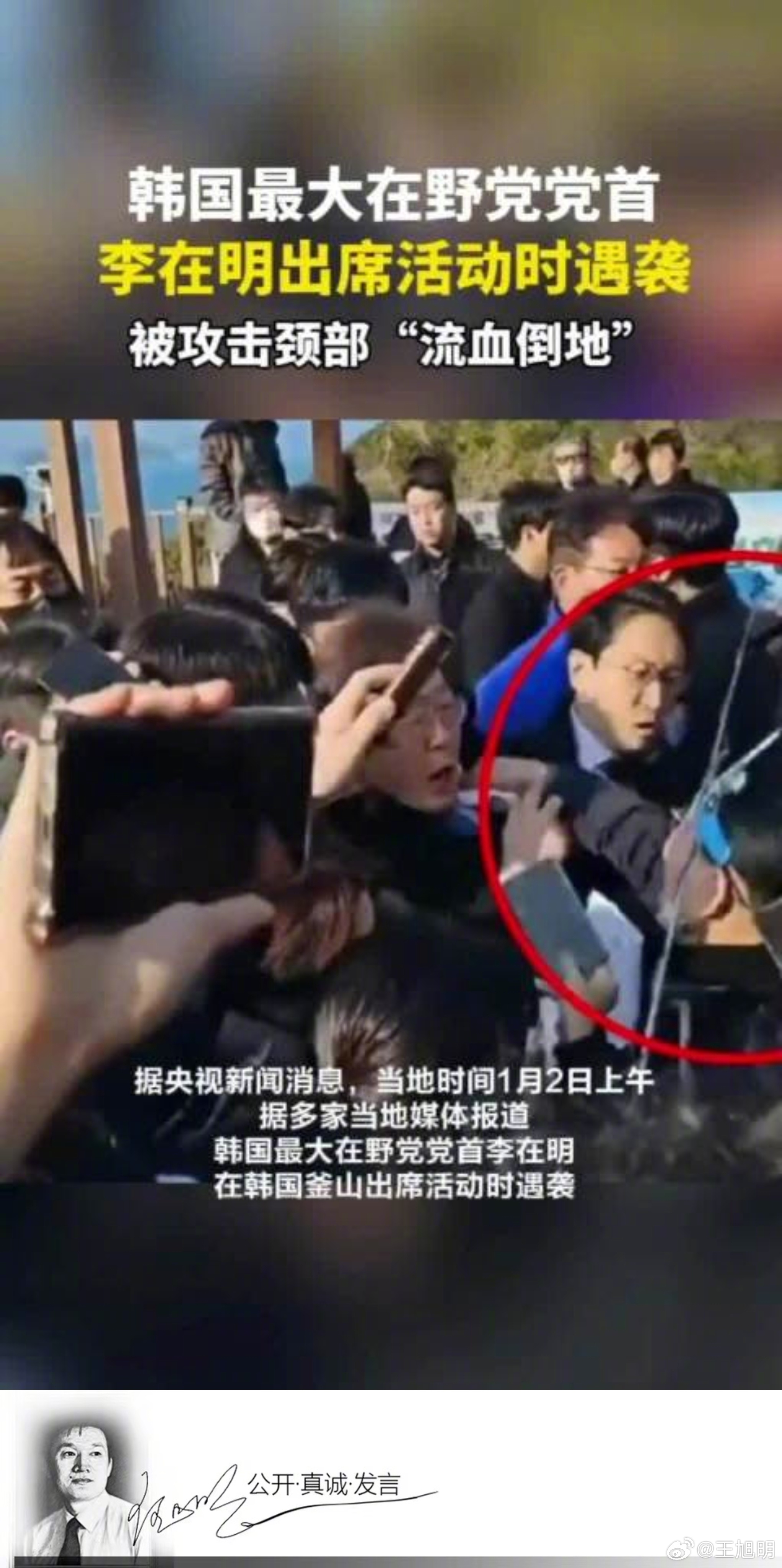 #旭评##李在明参加活动时遇袭# 韩国最大在野党党首李在明在韩国釜山出席活动时遇