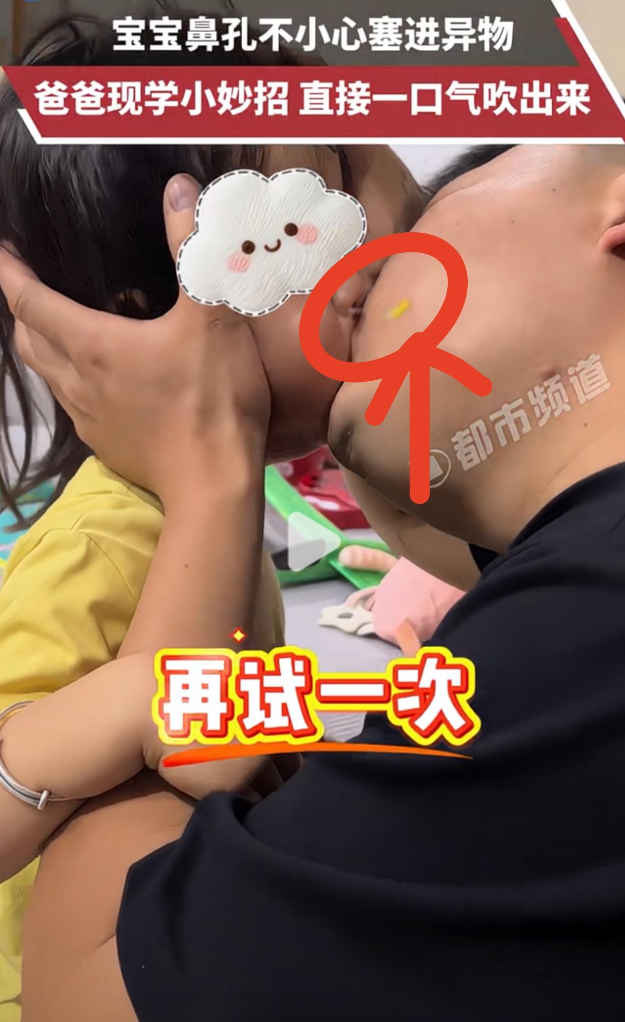安徽的爸爸:“等一下，嘴巴张大一点！”
宝宝难受！
宝宝鼻孔不小心塞进异物，爸爸
