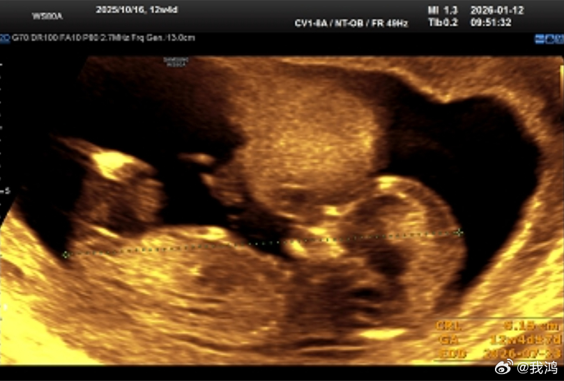 你笑一点一点一滴漾开。🥰大家觉得孩子是像爸爸还是像妈妈？ 我鸿的恋爱日记