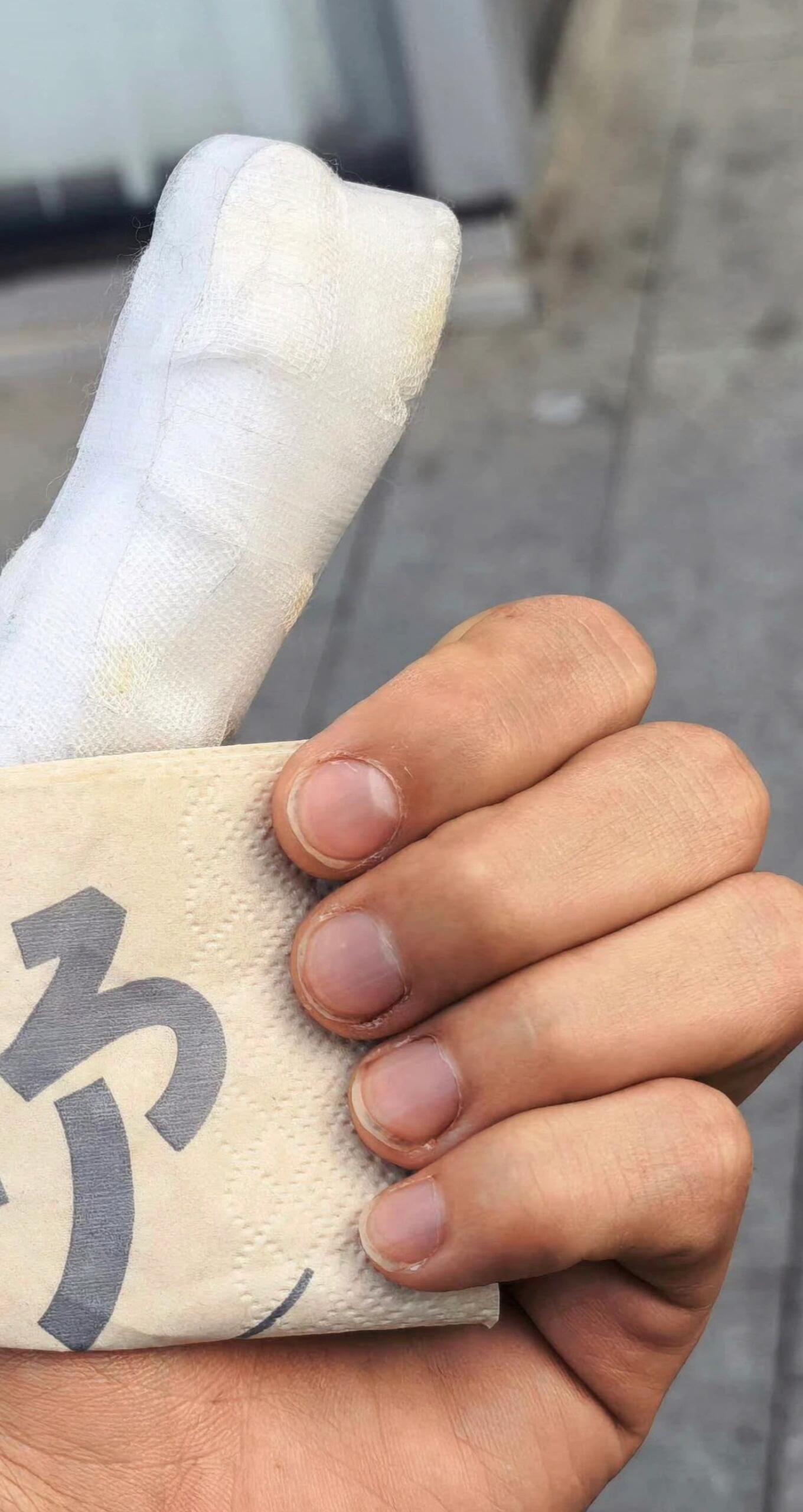 都这样了还哄我们开心可是我好像看到了其他手指甲边也有点红红的十个勤天  |  种