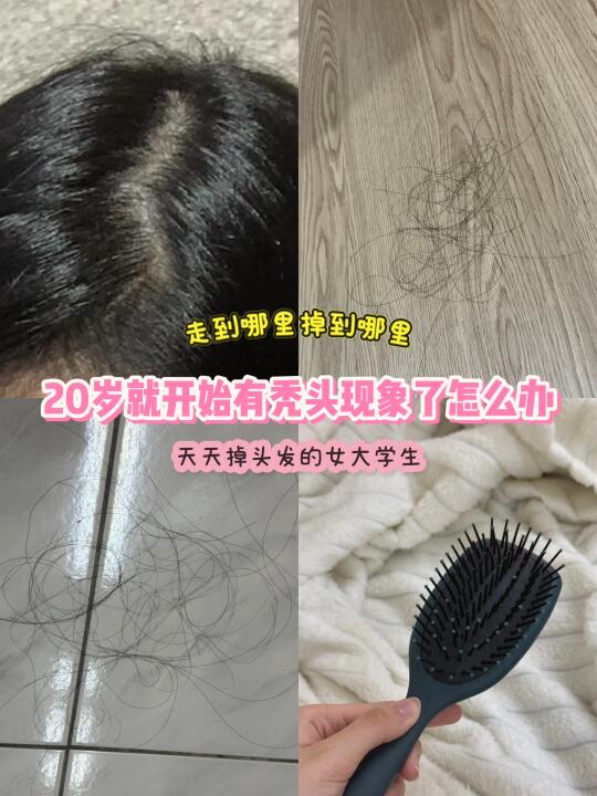 🇲🇾女大学生有秃头现象 好崩溃呀😩！！