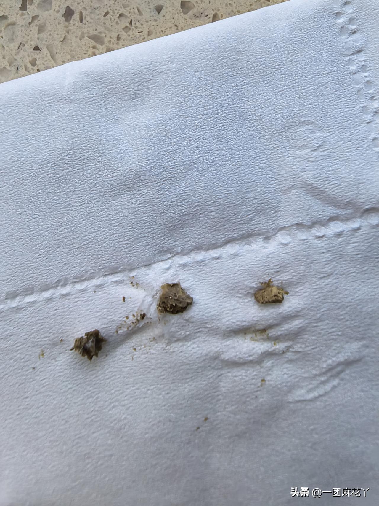 真是好消息呀。
早上5点姐就打电话给我，“老妹儿呀你快看看这是不是结石呀？我在微
