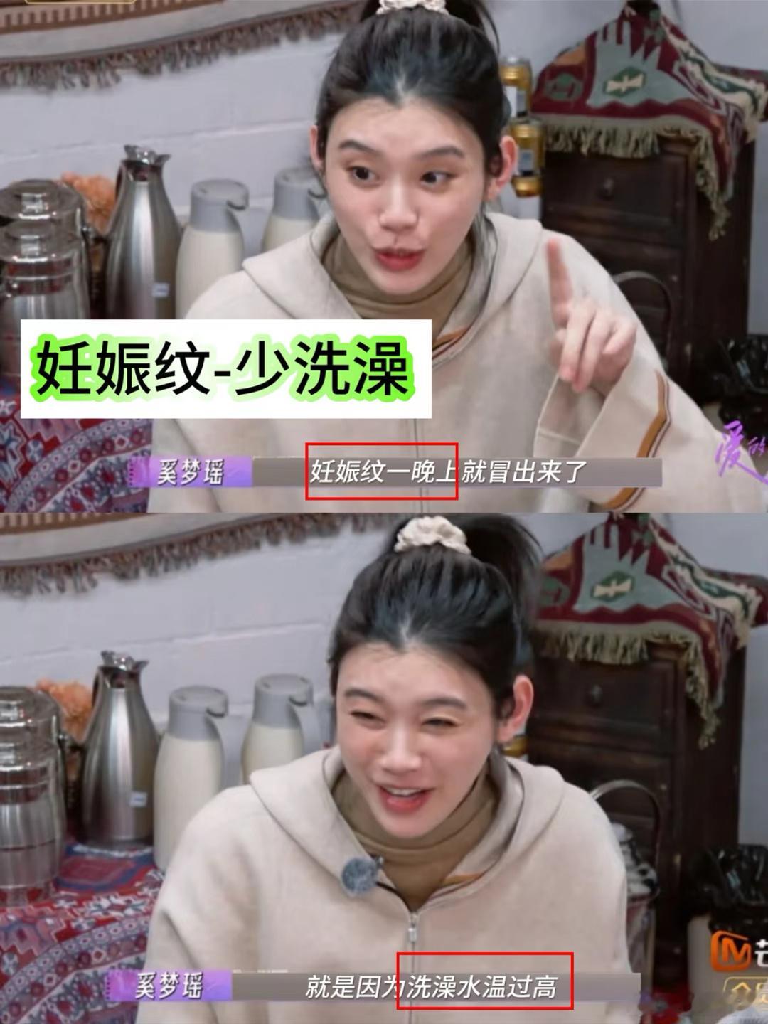 奚梦瑶在综艺里说家庭医生告诉他妊娠纹要少洗澡，又学到了新知识[鼓掌] 