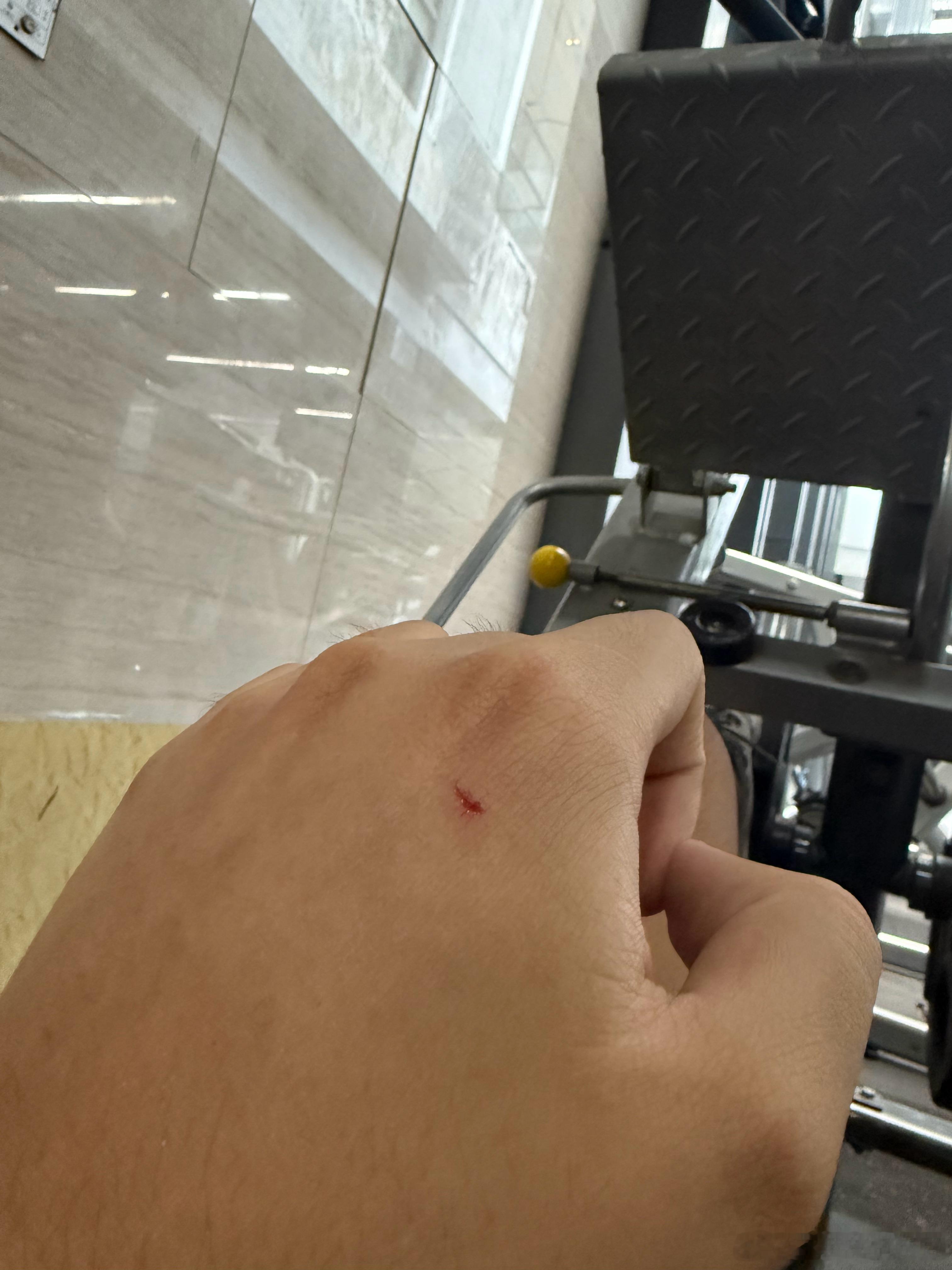 撞器械上了，有点锈不至于什么破伤风吧，我是无所谓主要一查感觉明天就要嘎了…急，在