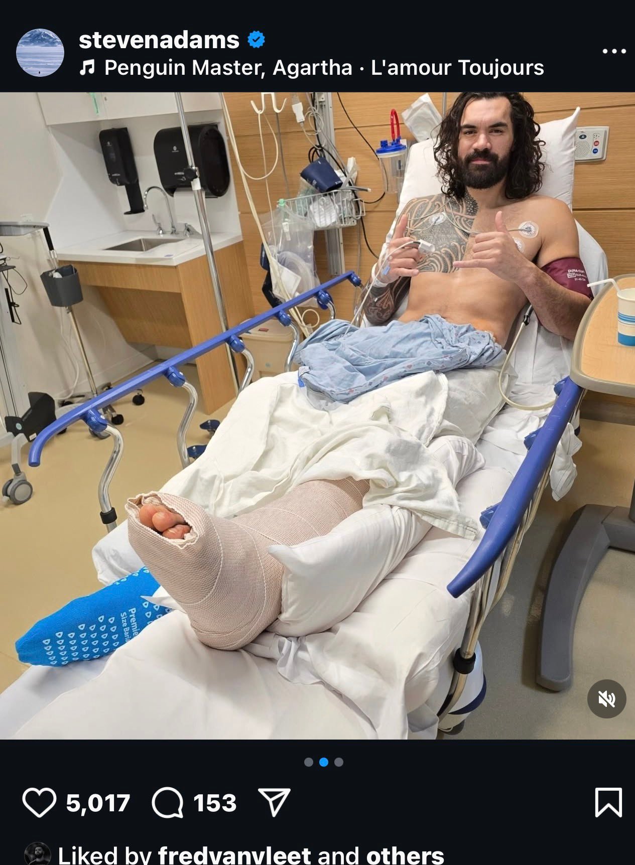 怪不得传出来火箭要补中锋，亚当斯接受了左脚踝手术，赛季报销…这下火箭本赛季彻底不