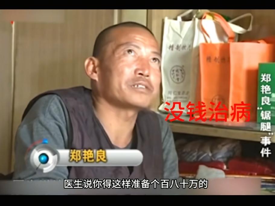 天下第一狠人！男子双腿坏死，需要100万做切除手术，男子没钱做手术，妻子已经准备