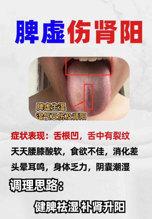 肝脾失调伤肾气，舌象辨证调理法