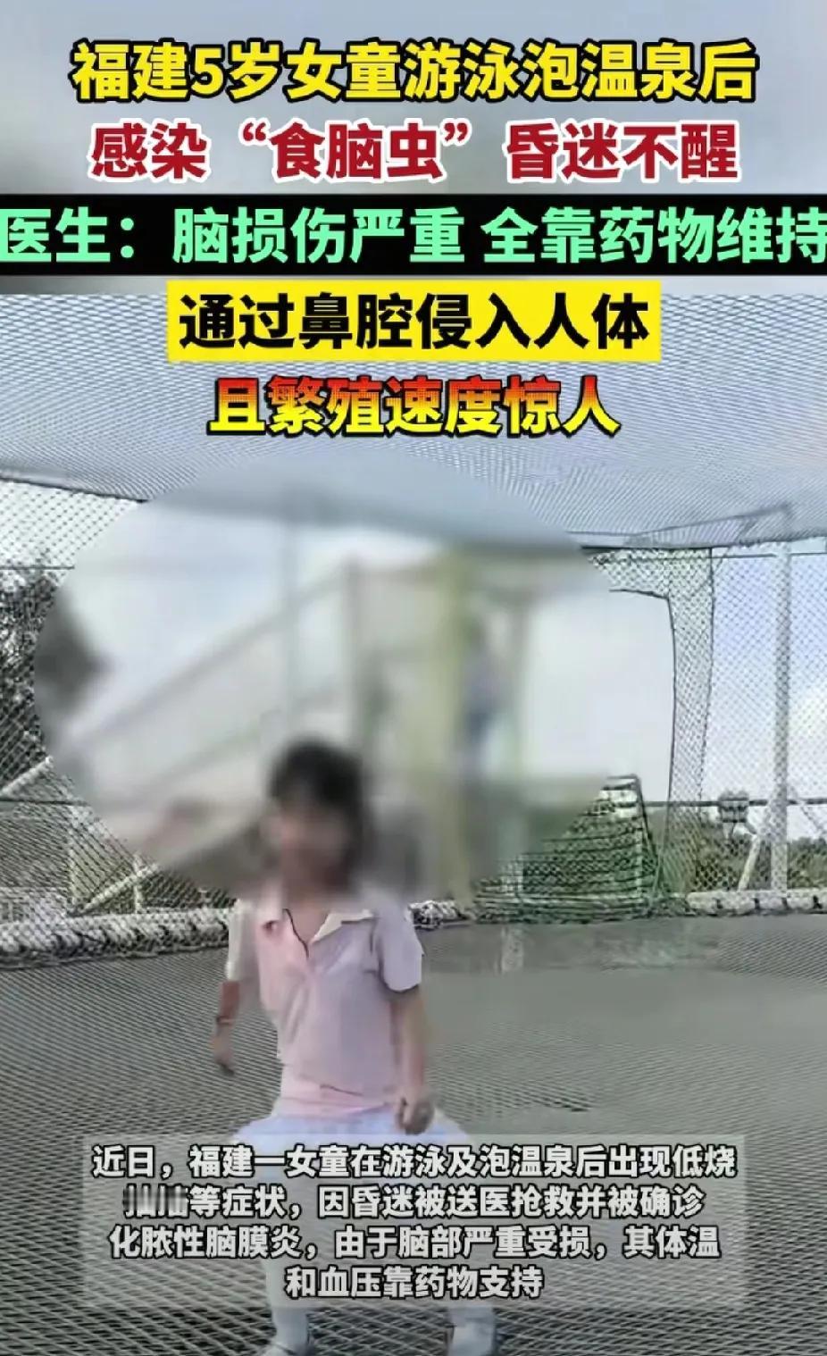 “食脑虫”我儿子可能就感染了，上个月跟他的表姐去游泳馆游泳，当天晚上回家就开始出