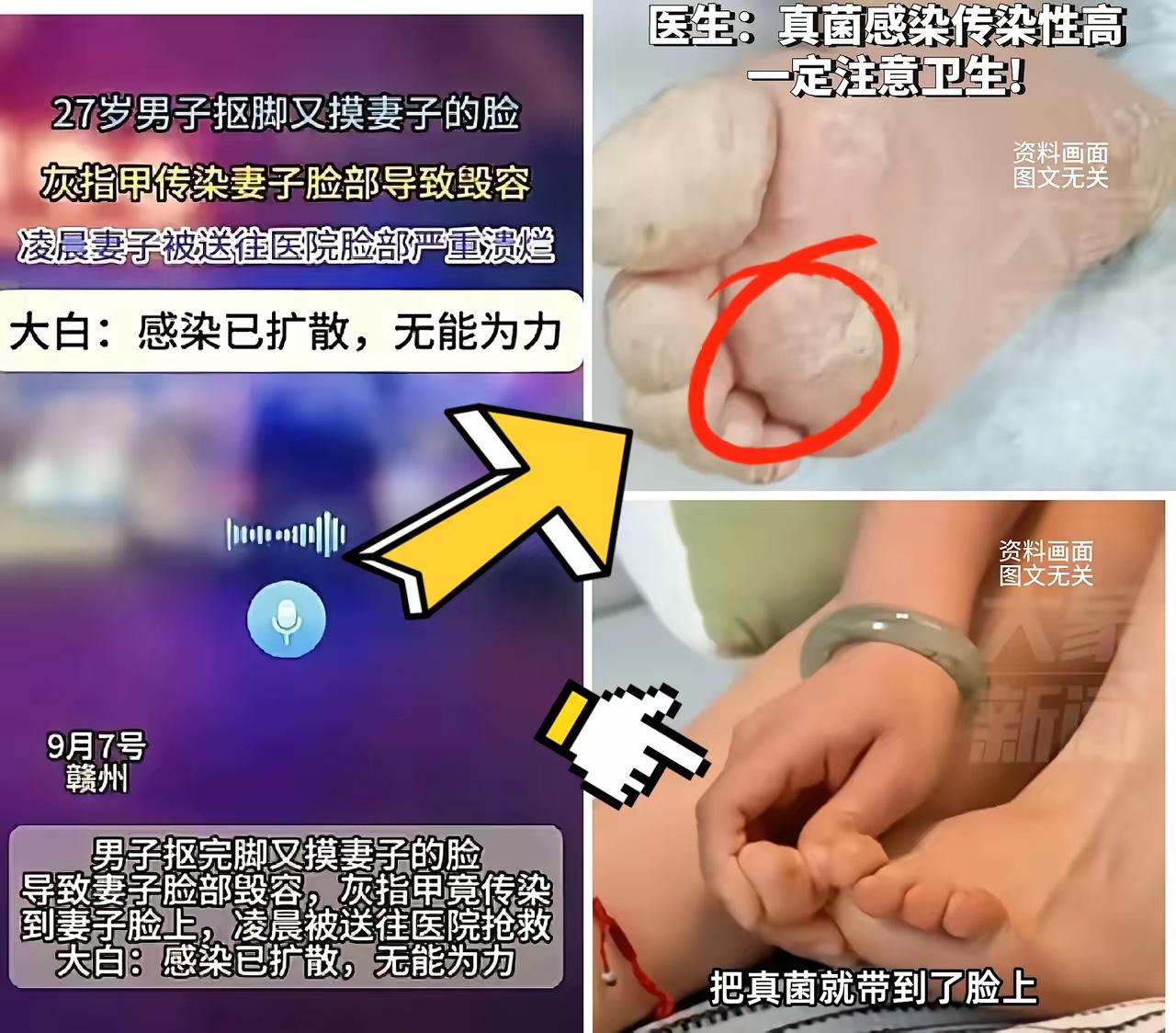 “真的太可怕了！”江西，27岁男子抠过脚没洗手，又去摸妻子的脸，妻子被摸过感觉面