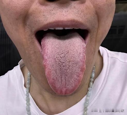 管住嘴，管住嘴，说了多少遍了，就是没人听啊[捂脸][捂脸][捂脸]
这大哥一看就