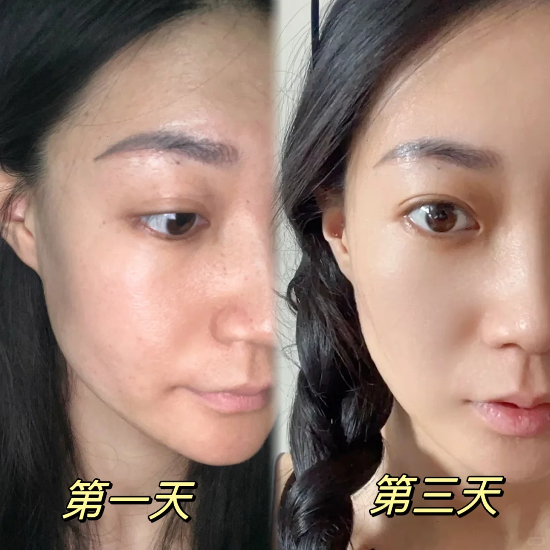 🍋第三天｜瑕疵皮逆袭记