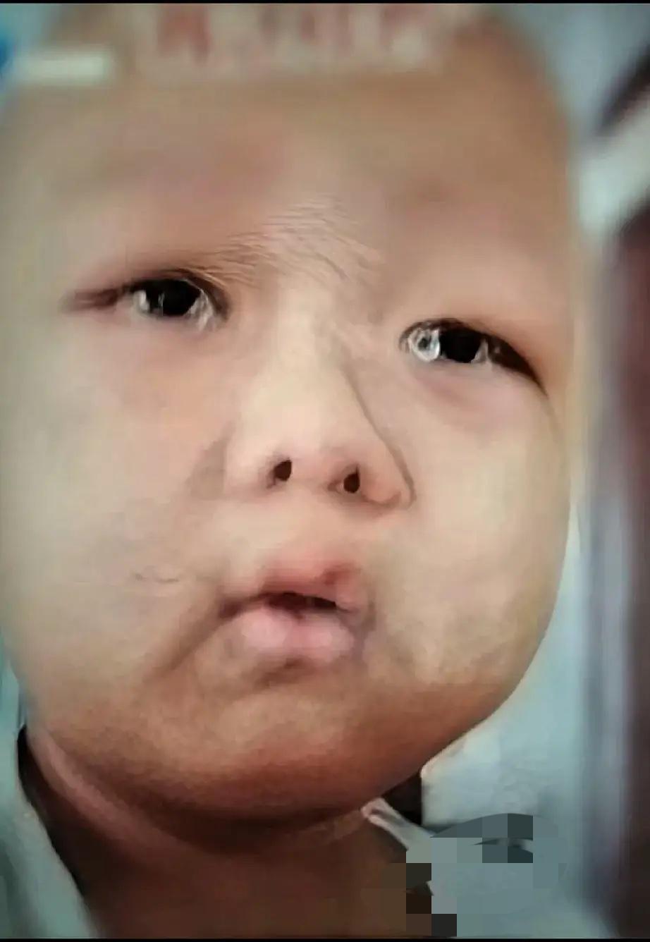 泪目了！儿子得了白血病，在离世之前突然望着妈妈，气若游丝地开口：“妈妈啊……等我