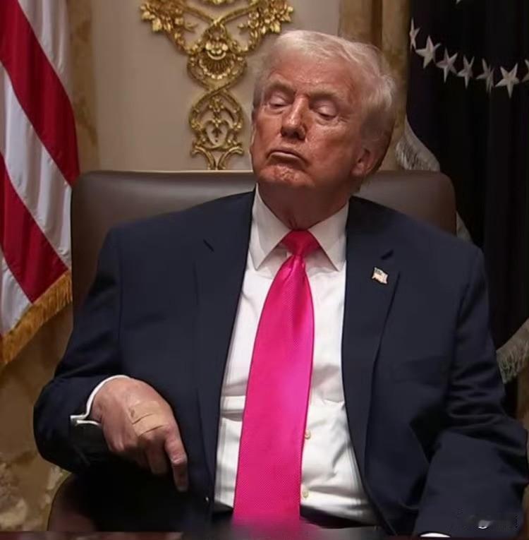 特朗普手上贴了类似创可贴的东西，昨天两块，今天一块，引发网民关注和猜测。 难道是