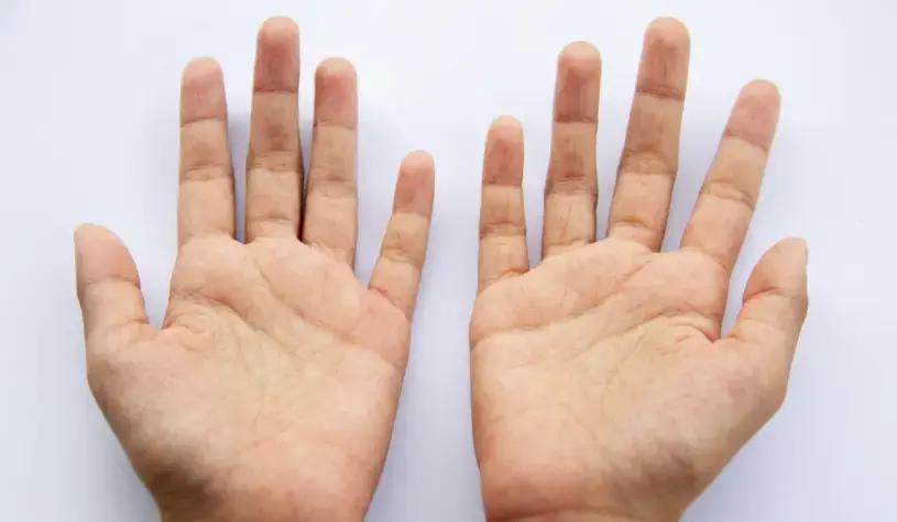 70岁王大爷晨练后在公园长椅上擦汗，发现自己手指灵活、皮肤细腻，而同龄老张手关节