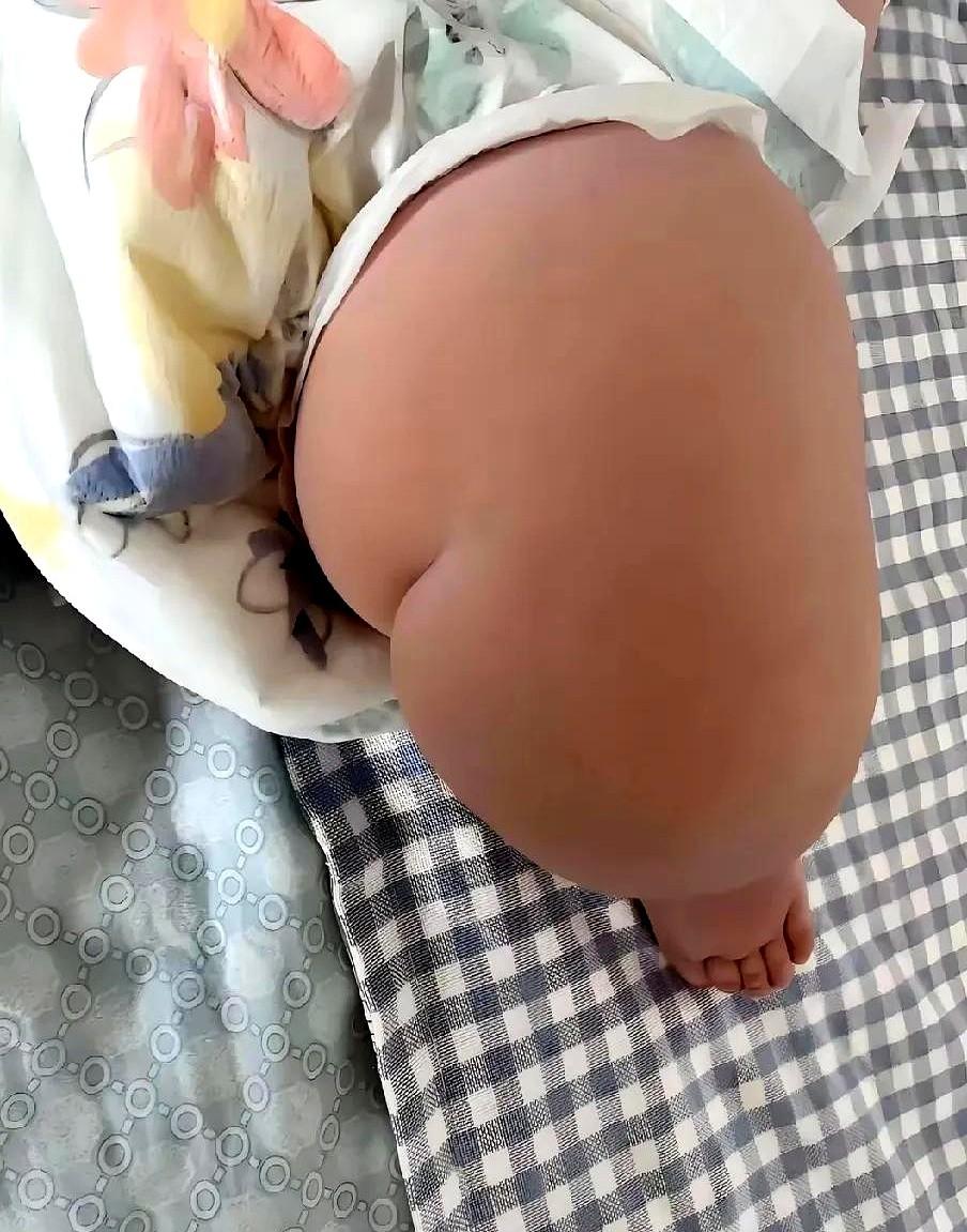 愁死了！

我姐家10个月大的孙子，都快20斤了！

医生说这体重严重超标，让控