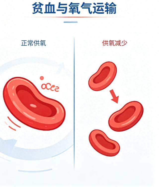 重度贫血两年没好，进口补铁剂吃了个遍，不如几十块的东西