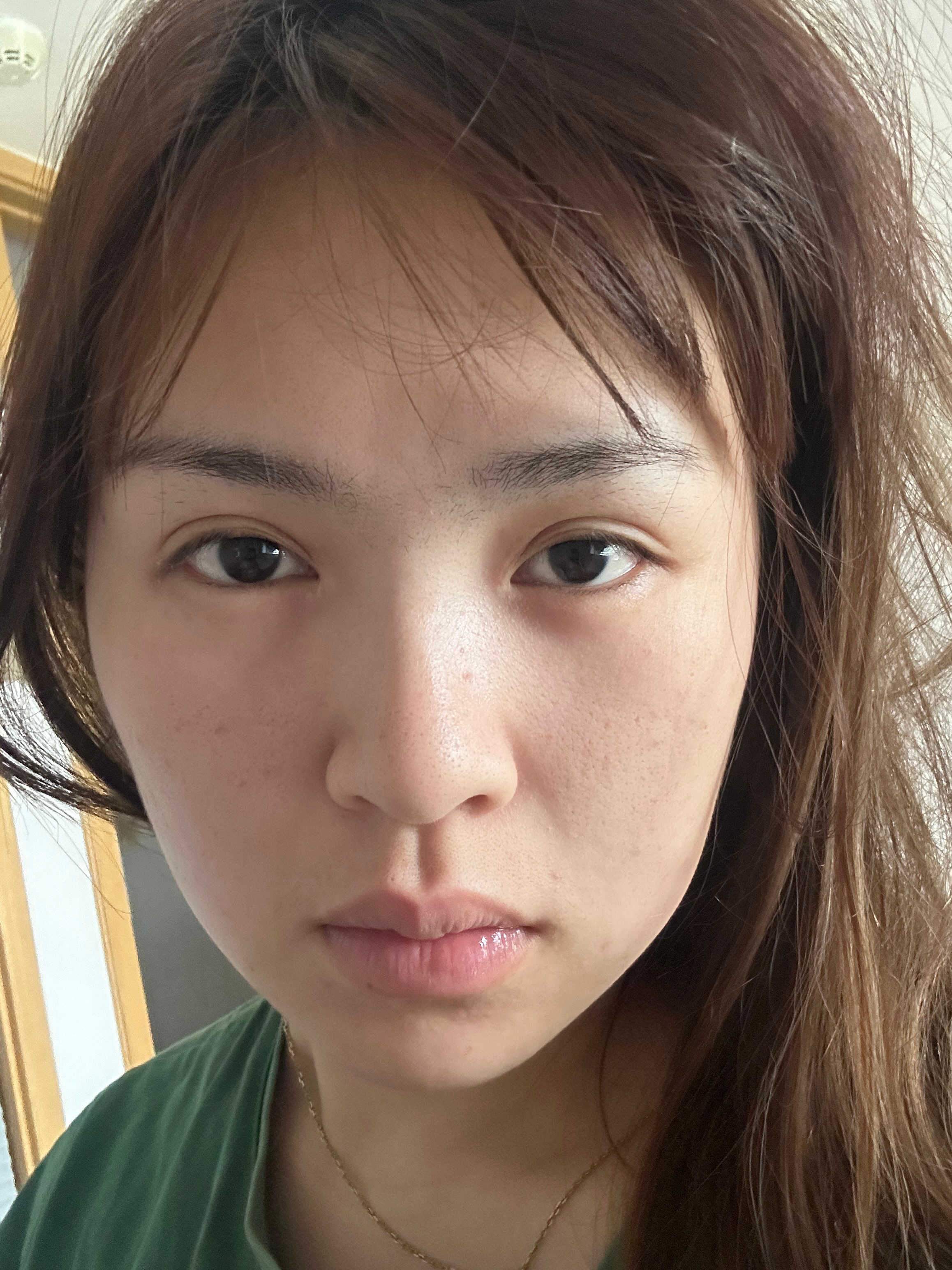 已经开始肿了我从今天开始成立螺狮粉受害者联盟 