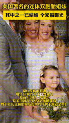 恭喜！“双头姐妹”之一已经结婚，美国这对双胞胎姐妹腰部以下器官全部共用，她们共用