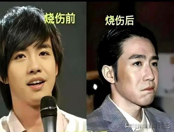 俞灏明拍《惊天救援》爆破戏时，有个男人在片场连蹲三天盯安全设备。

谁也没想到，