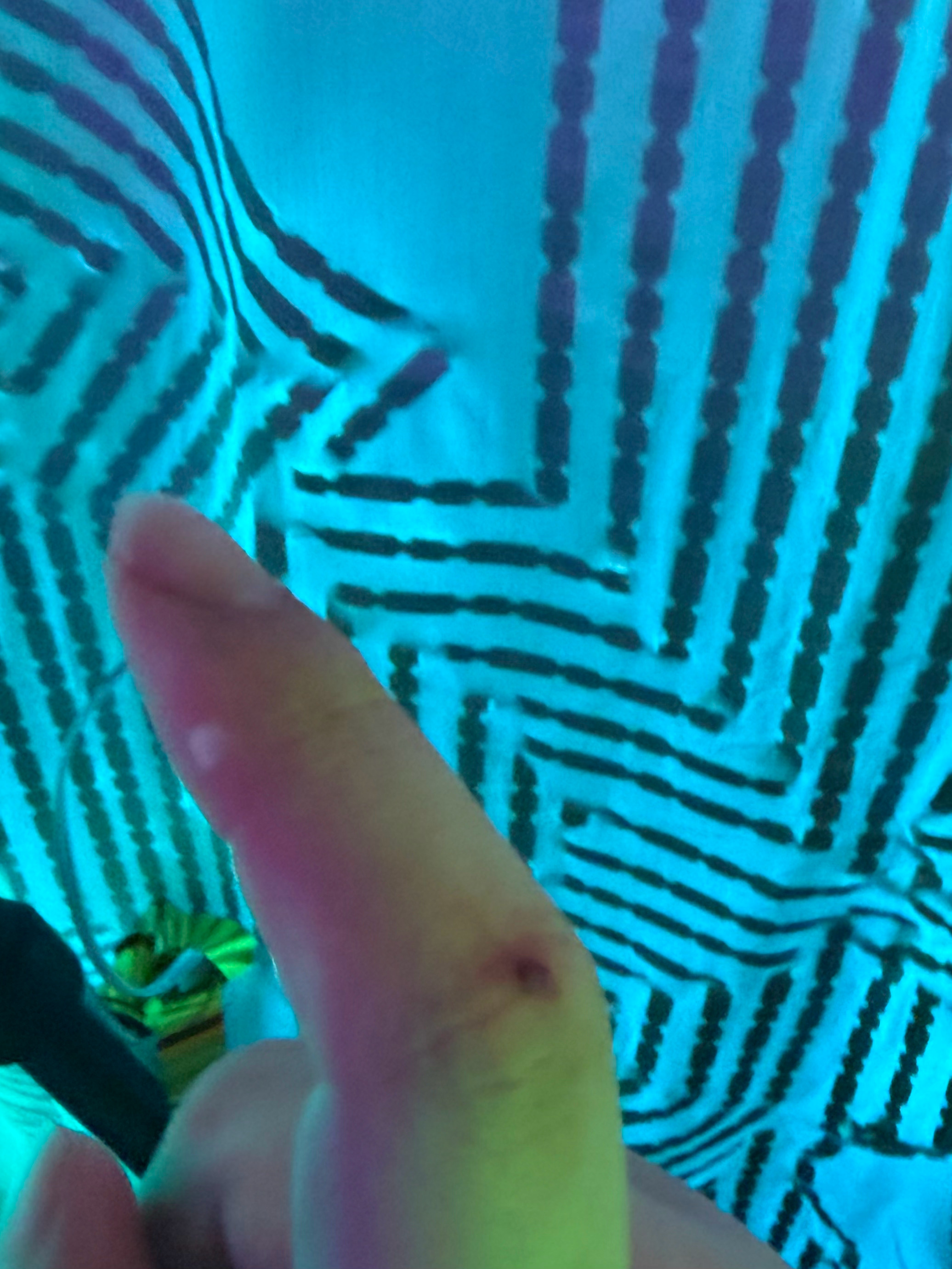 我宝子手咋破了想起了第一天我的手。这波倒也不必有缘 