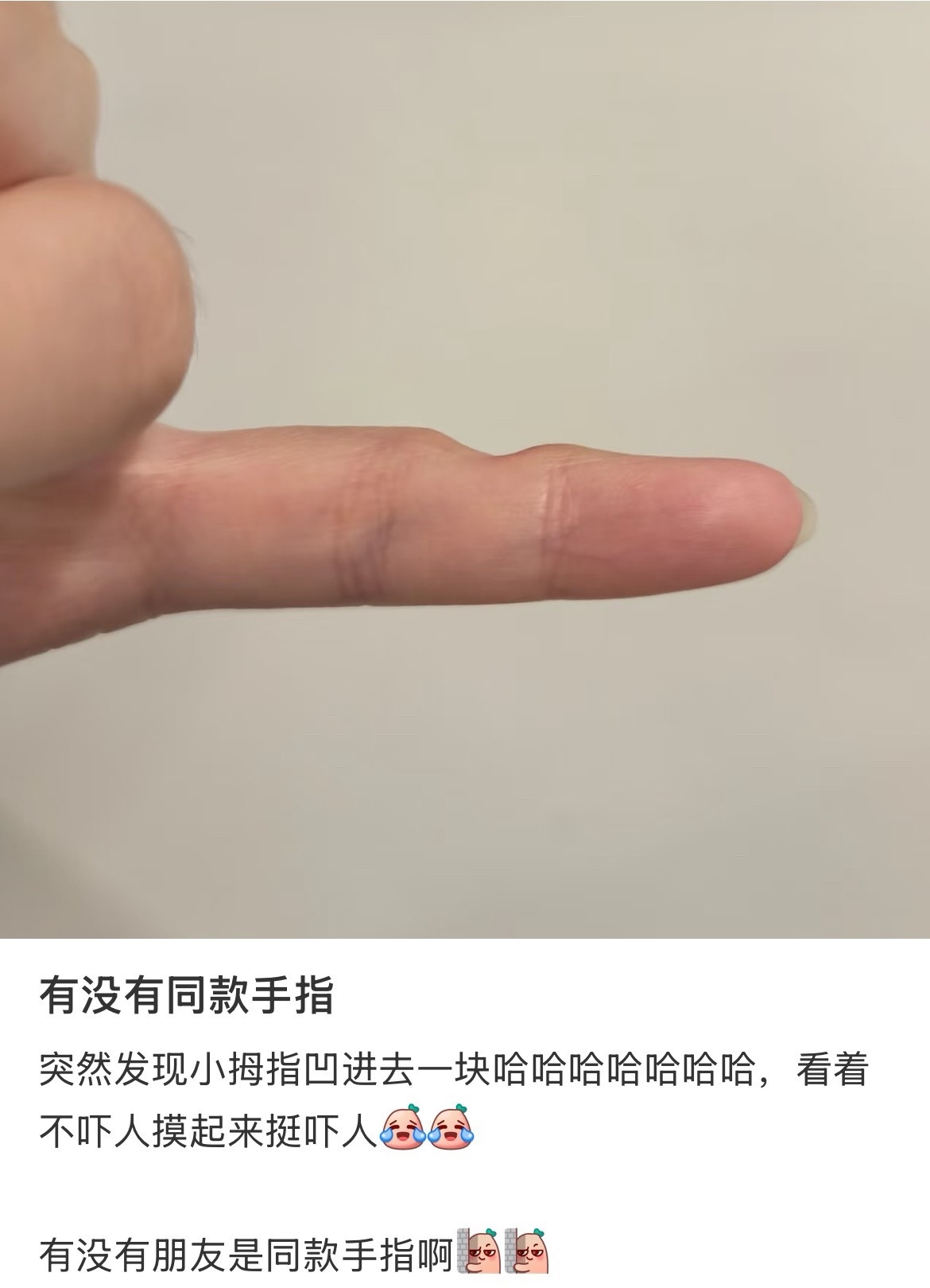 身边很多朋友都有手机依赖症，个人由于工作原因，也是深度手机用户，前几年感觉还好，