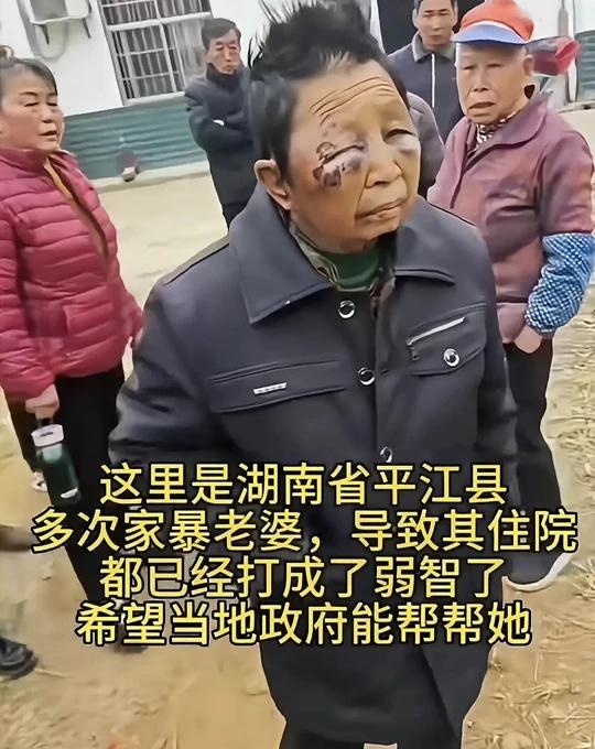 鉴定轻微伤？？
一早上看到这个好生气啊
帮帮别人助助自己 不做冷漠的看客 看不得