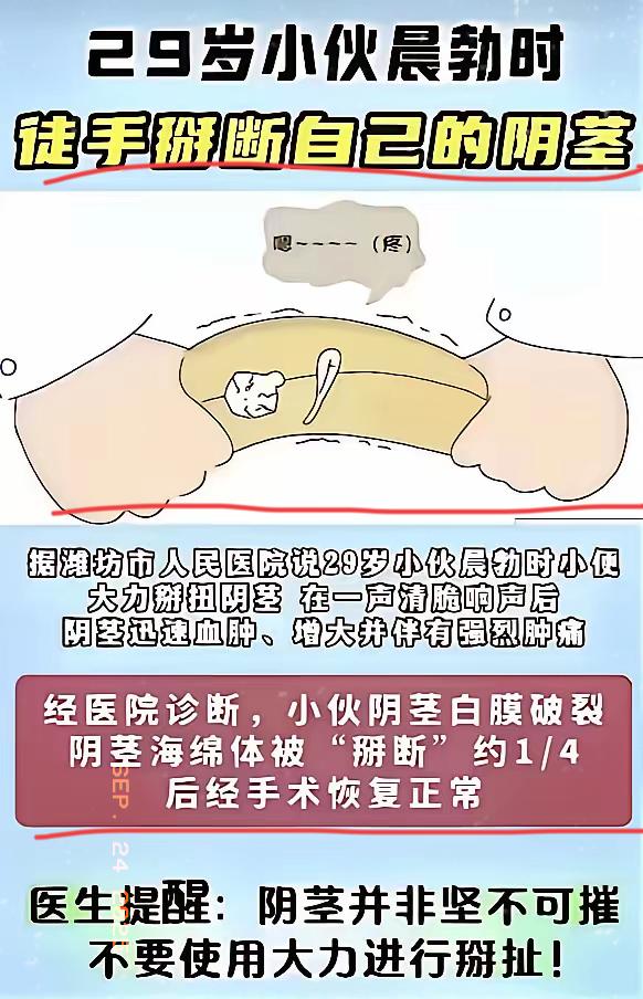 潍坊这事儿太绝了！
​潍坊一小伙子晨勃时用手掰断了自己的阴茎，这事儿出圈了。
