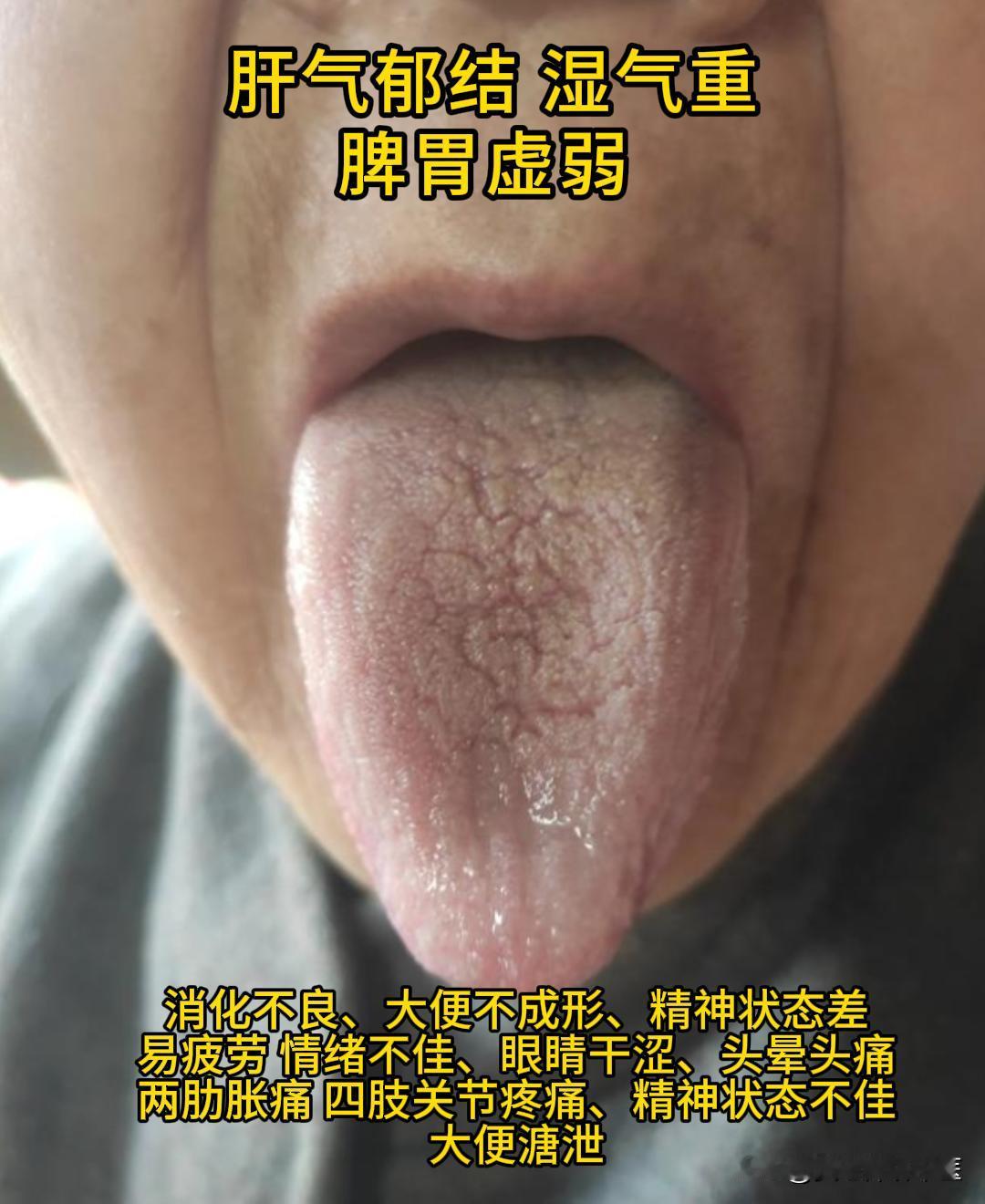 现在有时间，可以帮大家看看舌象。

有需要的，尽管把你的舌象照片发过来吧！越早发