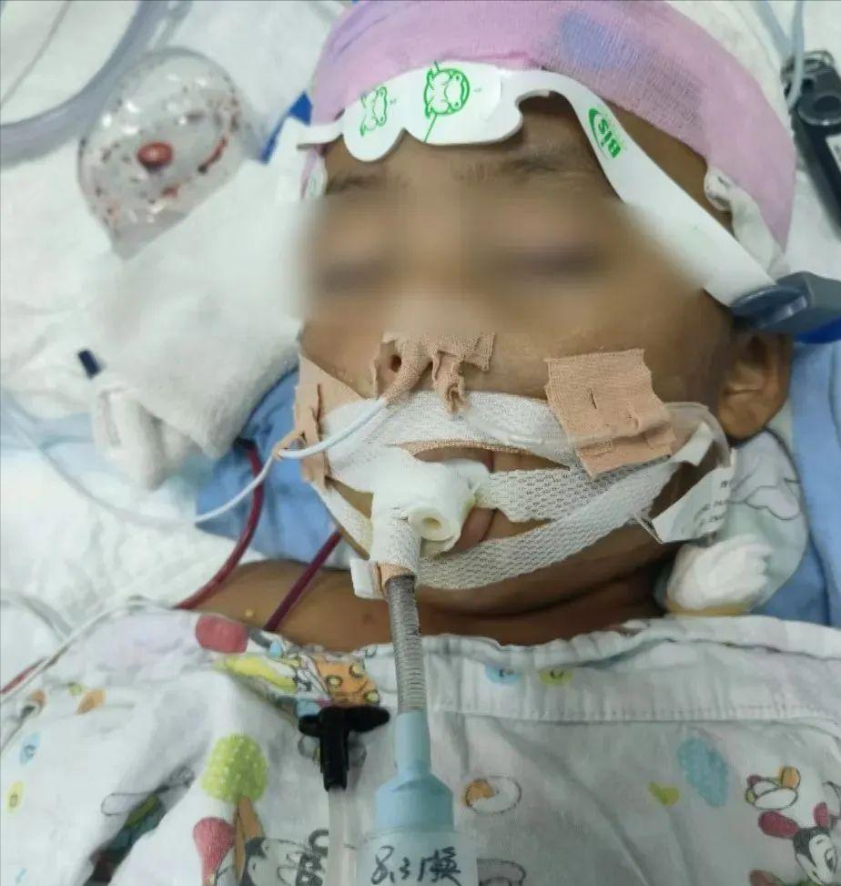 上海，3岁男童被生父的女友打进了医院，最终无力回天，生父要求拔管出院，医生通知生