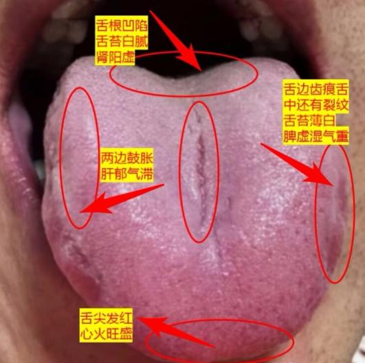 宁可药生尘，也不愿人生病！今天继续公益看舌象！你发我看，直出结果！

舌象拍完整