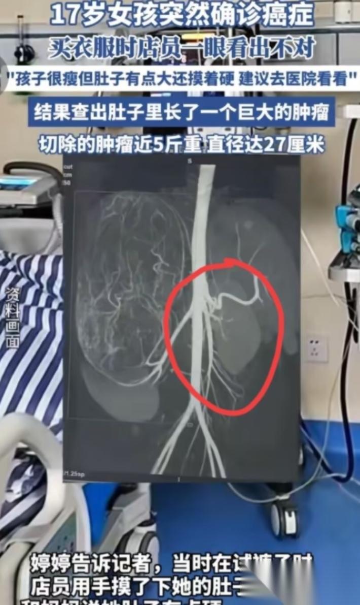 “幸亏发现了！”广东17岁女孩和妈妈一起逛街买衣服，在试裤子的时候，老板娘发觉女