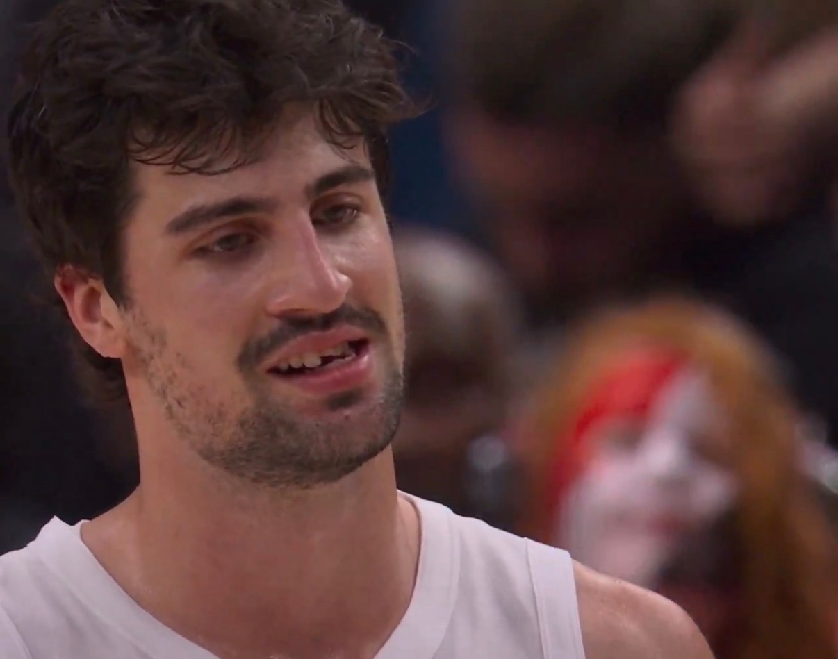 阿夫迪亚防福克斯这球，和昨天迪温琴佐的一样，虽然脸被对面投篮手打到了，但裁判都给