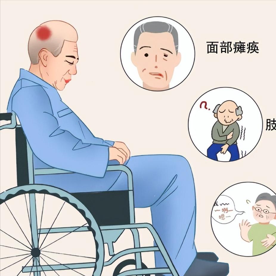 脑梗都是懒出来的！这两个坏习惯不改，仍旧会复发
很多人都有这样的困惑：明明按时吃