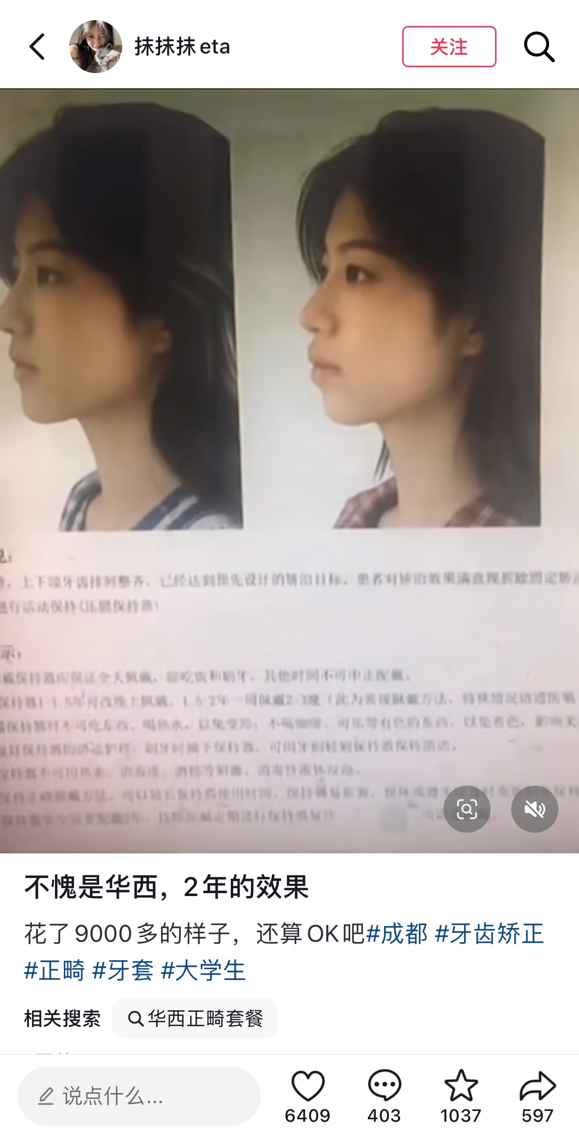 关于正畸的 这个真的算是逆天改命了…. 